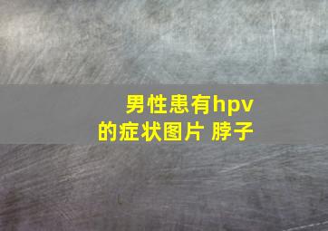 男性患有hpv的症状图片 脖子